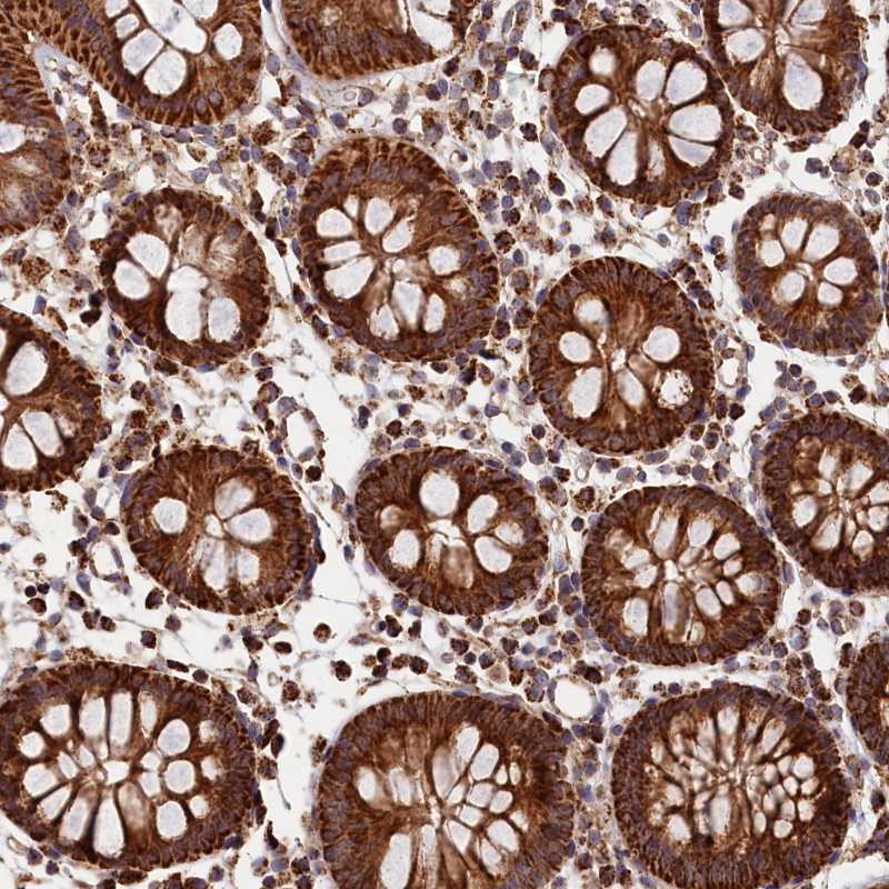 Atlas Antibodies Anti-MACROD1 Antibody