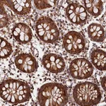 Atlas Antibodies Anti-MACROD1 Antibody