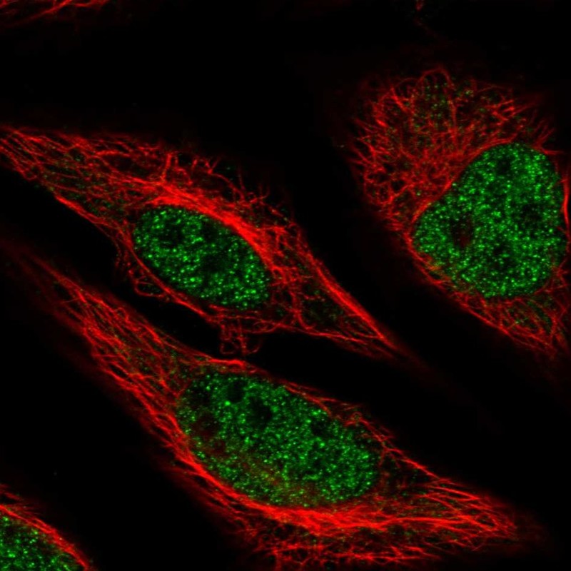 Atlas Antibodies Anti-MACROD1 Antibody