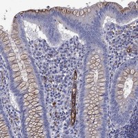 Atlas Antibodies Anti-MADCAM1 Antibody