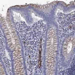 Atlas Antibodies Anti-MADCAM1 Antibody