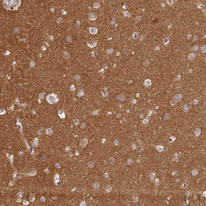 Atlas Antibodies Anti-MADD Antibody