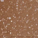 Atlas Antibodies Anti-MADD Antibody