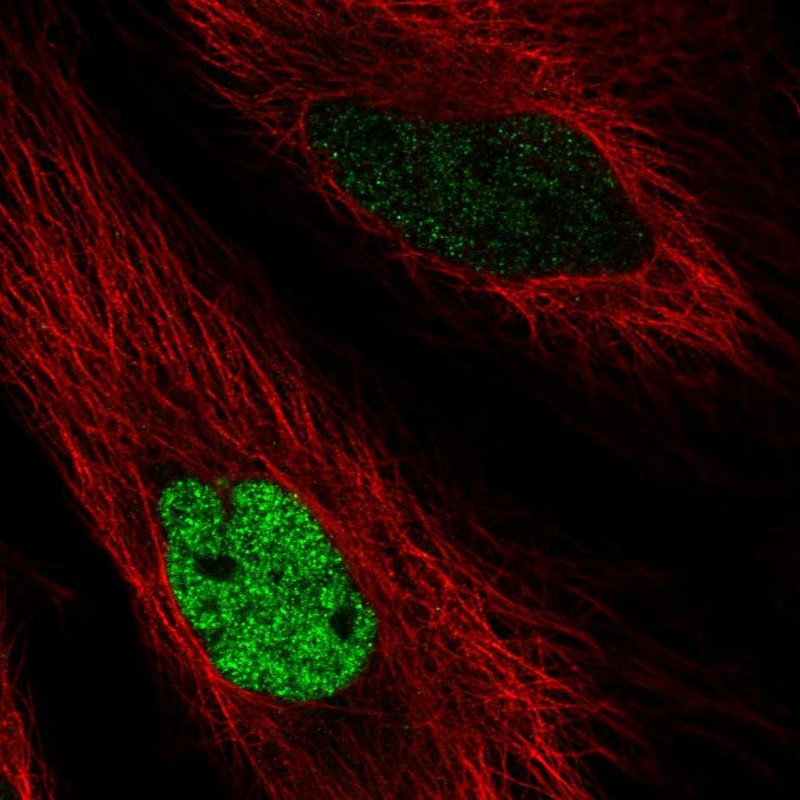 Atlas Antibodies Anti-MAFK Antibody