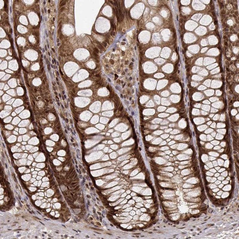 Atlas Antibodies Anti-MAEA Antibody