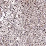 Atlas Antibodies Anti-MAF1 Antibody