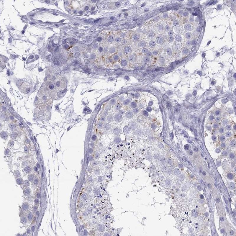 Atlas Antibodies Anti-MAEL Antibody