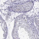 Atlas Antibodies Anti-MAEL Antibody