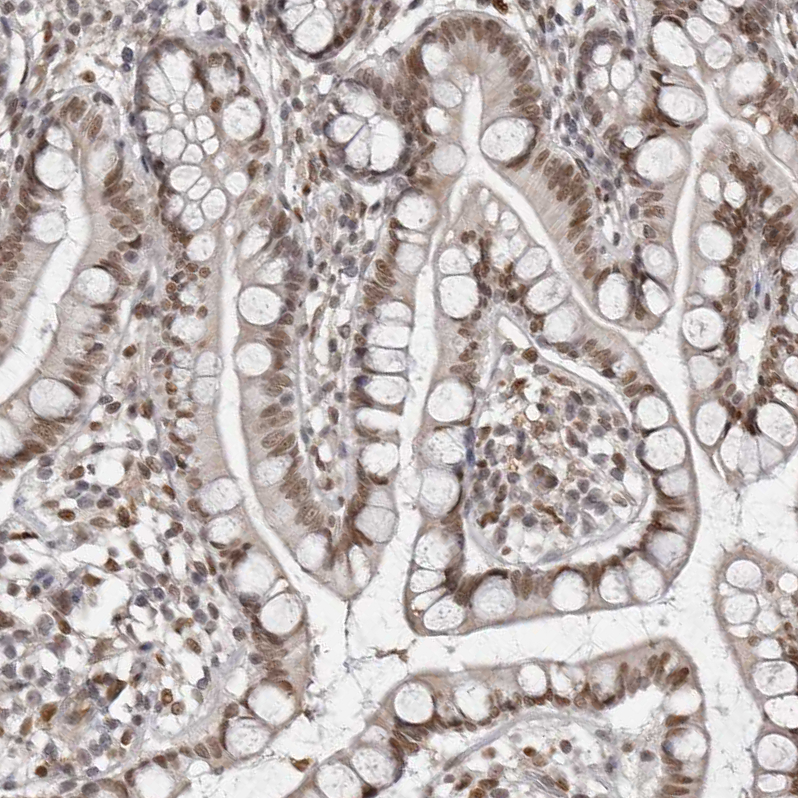 Atlas Antibodies Anti-MAF Antibody