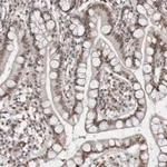 Atlas Antibodies Anti-MAF Antibody