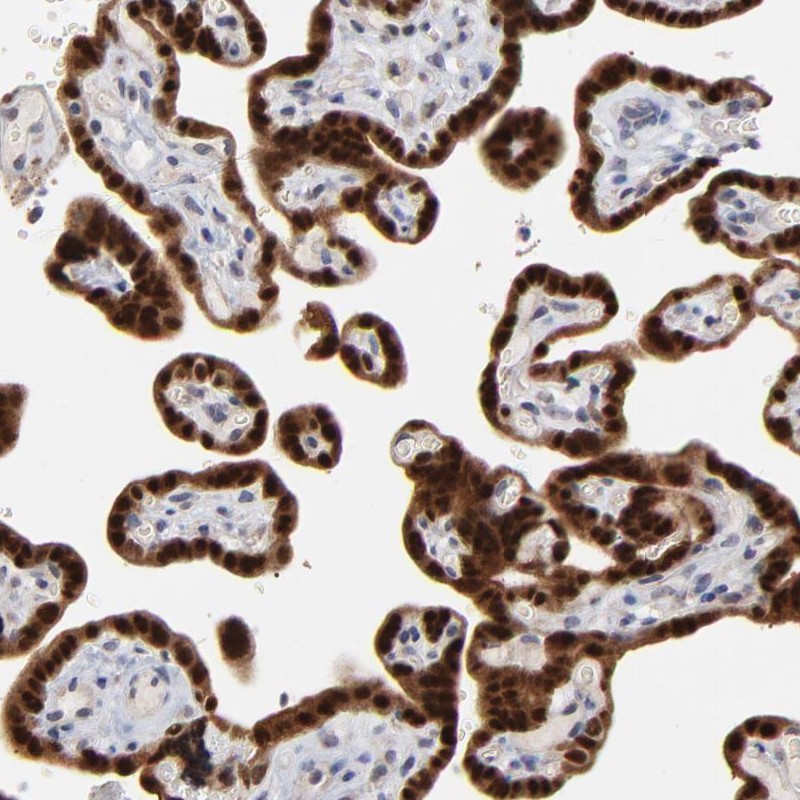 Atlas Antibodies Anti-MAGEA10 Antibody