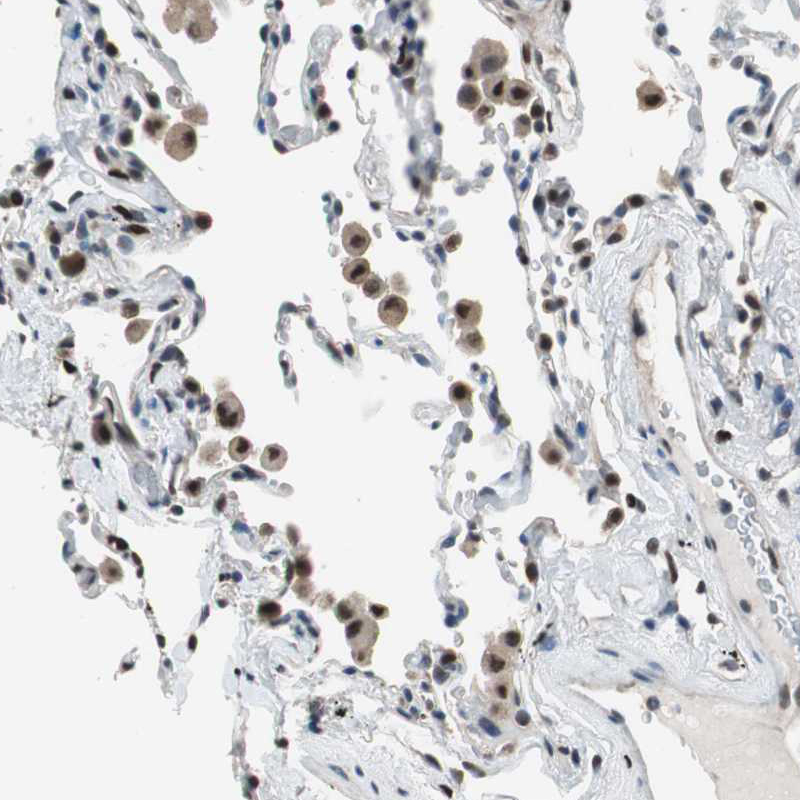 Atlas Antibodies Anti-MAFB Antibody