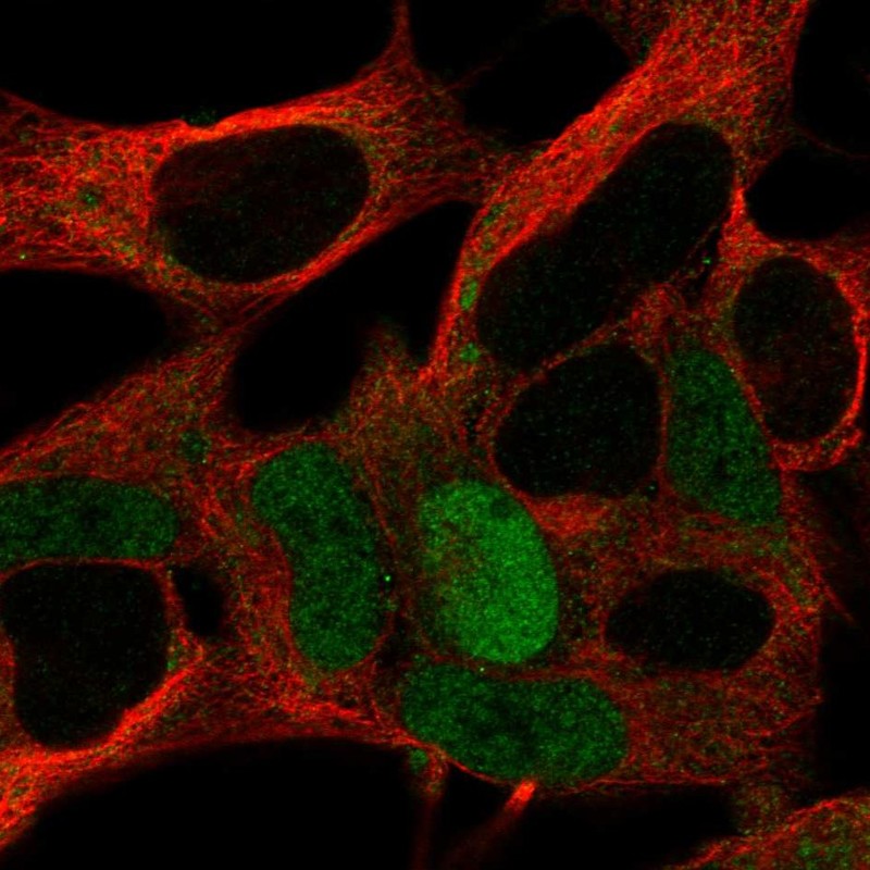 Atlas Antibodies Anti-MAGEA10 Antibody