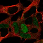 Atlas Antibodies Anti-MAGEA10 Antibody
