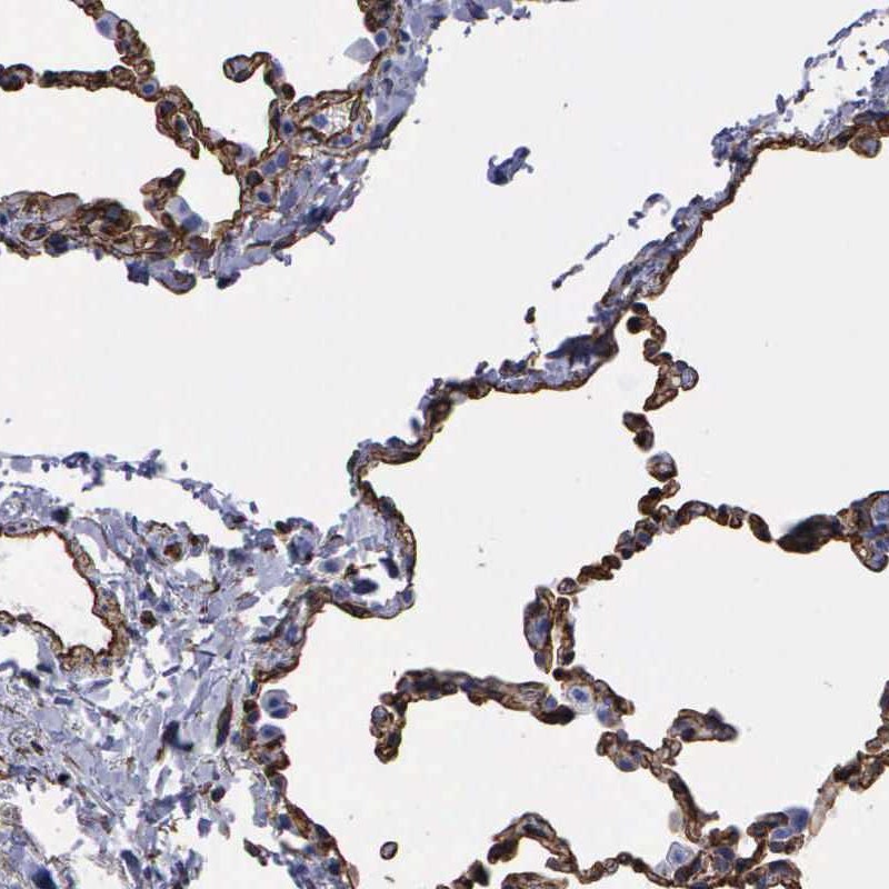 Atlas Antibodies Anti-MAGEB10 Antibody