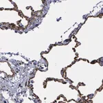 Atlas Antibodies Anti-MAGEB10 Antibody