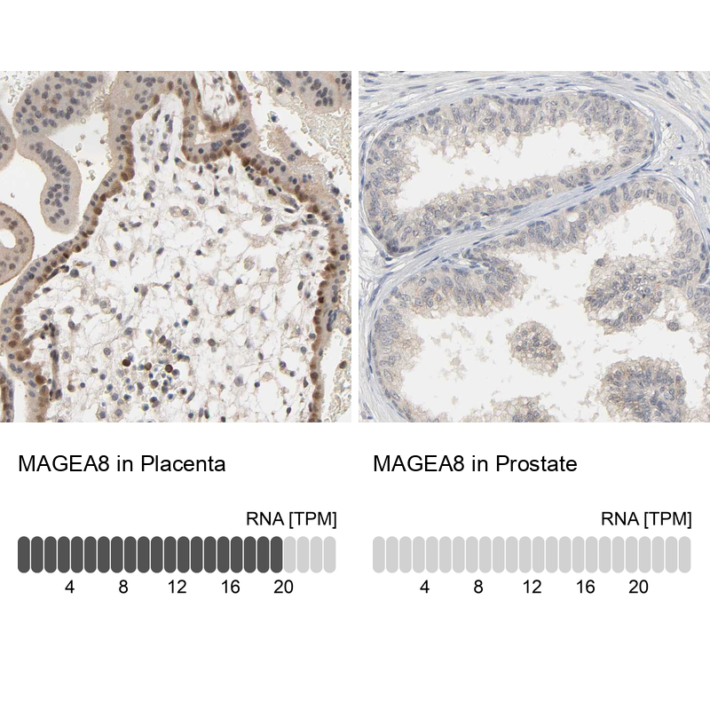 Atlas Antibodies Anti-MAGEA8 Antibody