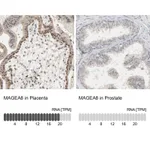 Atlas Antibodies Anti-MAGEA8 Antibody