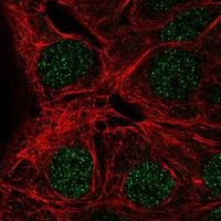 Atlas Antibodies Anti-MAGEA9 Antibody