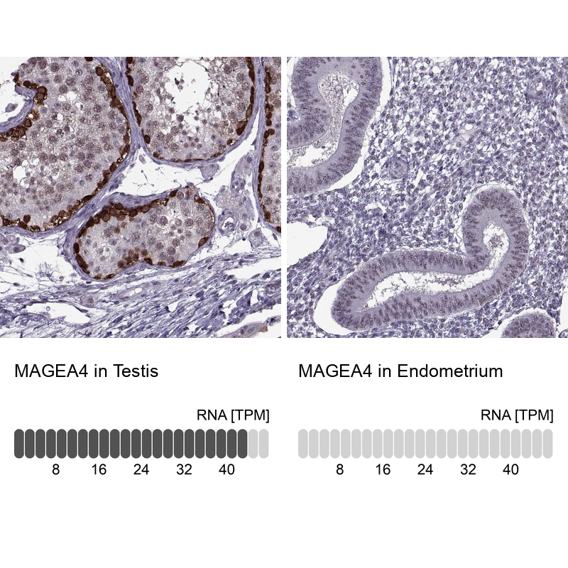 Atlas Antibodies Anti-MAGEA4 Antibody
