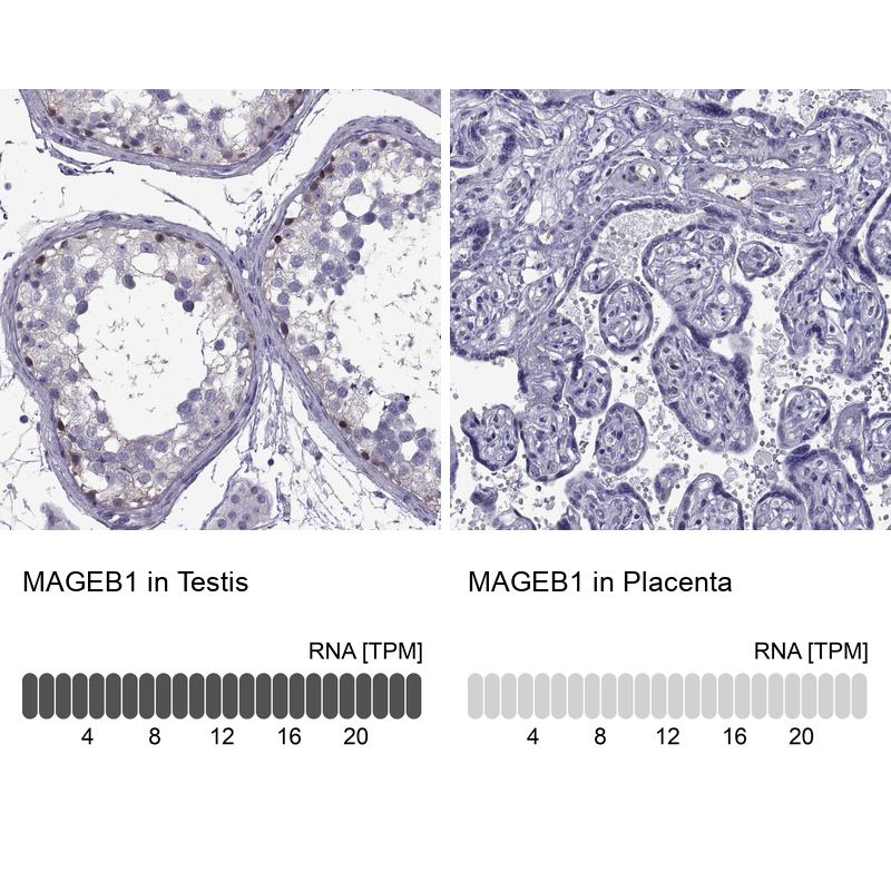 Atlas Antibodies Anti-MAGEB1 Antibody