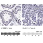 Atlas Antibodies Anti-MAGEB1 Antibody