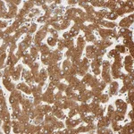 Atlas Antibodies Anti-MAGEB17 Antibody