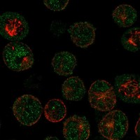 Atlas Antibodies Anti-MAGEB16 Antibody