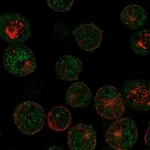 Atlas Antibodies Anti-MAGEB16 Antibody