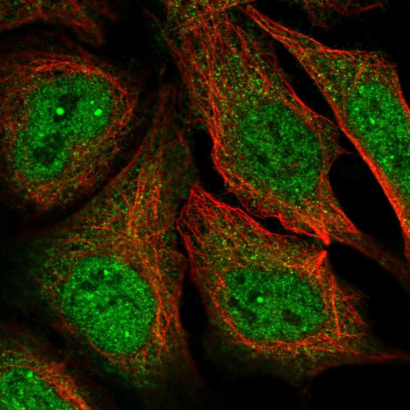 Atlas Antibodies Anti-MAGEA11 Antibody