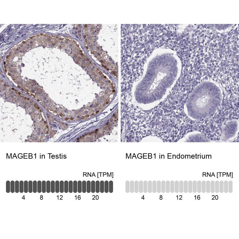 Atlas Antibodies Anti-MAGEB1 Antibody