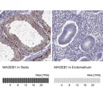 Atlas Antibodies Anti-MAGEB1 Antibody