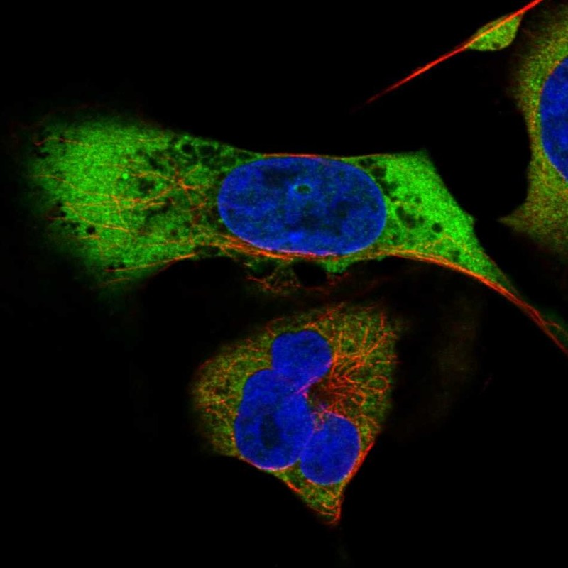Atlas Antibodies Anti-MAGEB2 Antibody