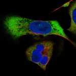 Atlas Antibodies Anti-MAGEB2 Antibody