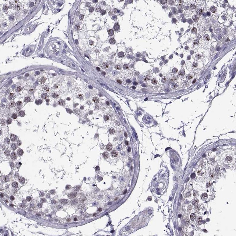 Atlas Antibodies Anti-MAGEB18 Antibody