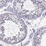Atlas Antibodies Anti-MAGEB18 Antibody