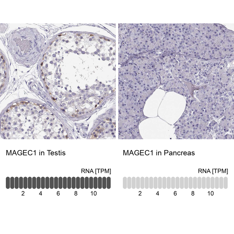 Atlas Antibodies Anti-MAGEC1 Antibody