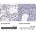 Atlas Antibodies Anti-MAGEC1 Antibody