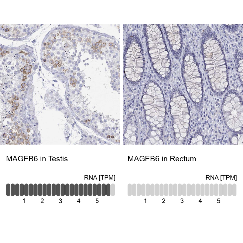 Atlas Antibodies Anti-MAGEB6 Antibody