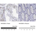 Atlas Antibodies Anti-MAGEB6 Antibody