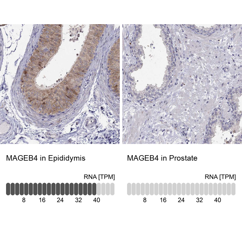 Atlas Antibodies Anti-MAGEB4 Antibody