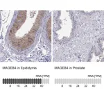 Atlas Antibodies Anti-MAGEB4 Antibody