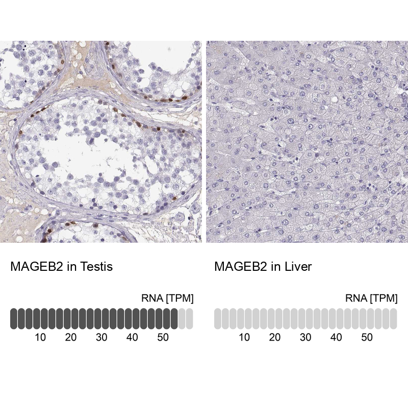 Atlas Antibodies Anti-MAGEB2 Antibody