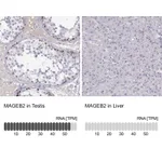 Atlas Antibodies Anti-MAGEB2 Antibody