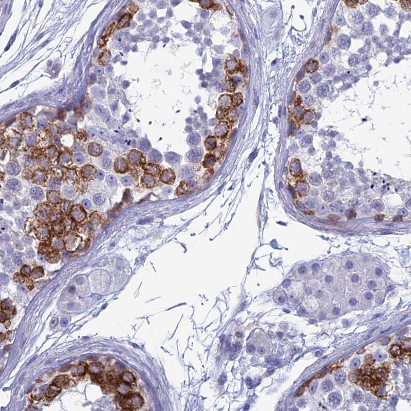 Atlas Antibodies Anti-MAGEB6 Antibody