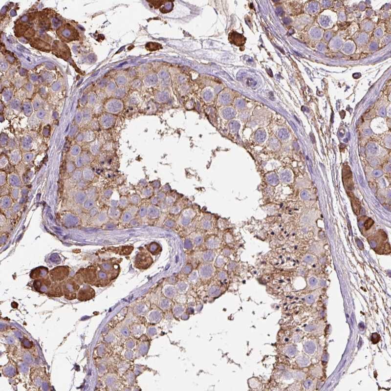 Atlas Antibodies Anti-MAGEB5 Antibody