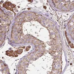 Atlas Antibodies Anti-MAGEB5 Antibody