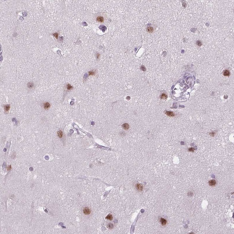 Atlas Antibodies Anti-MAGEB3 Antibody