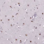 Atlas Antibodies Anti-MAGEB3 Antibody