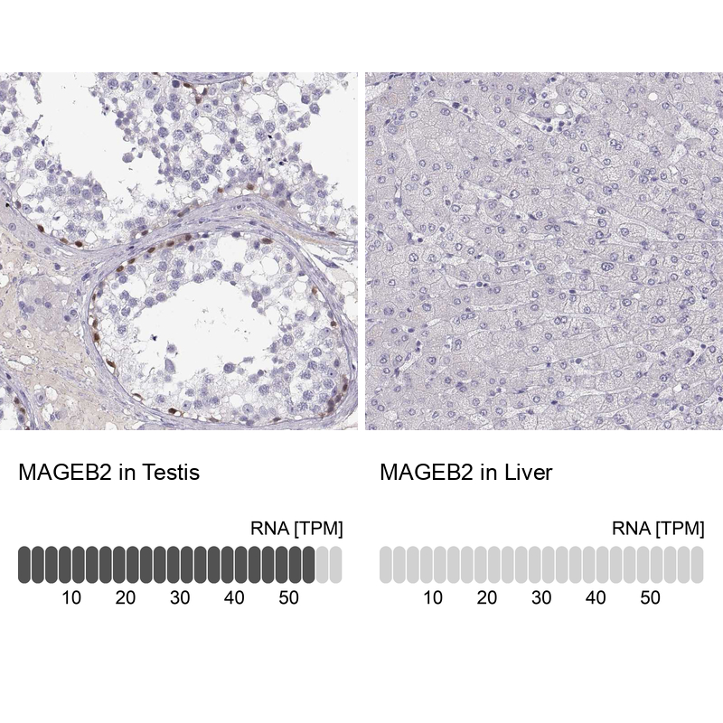 Atlas Antibodies Anti-MAGEB2 Antibody
